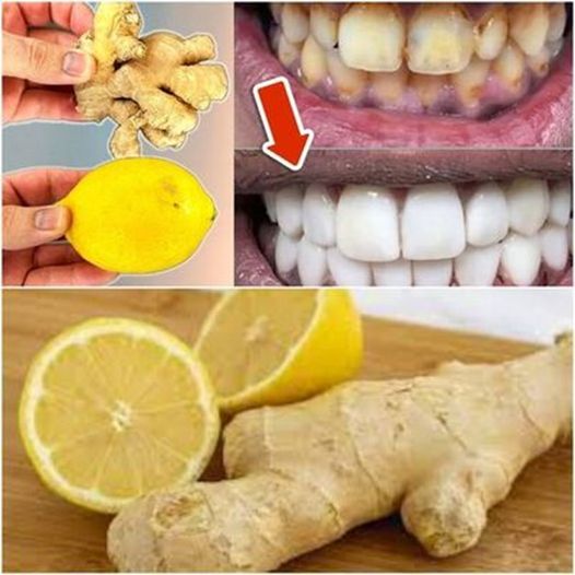 Brighten Your Smile with Simple Home Remedies